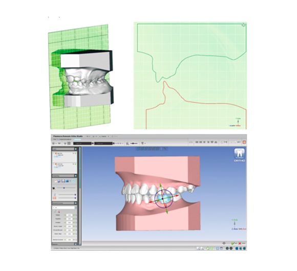 Planmeca 3D Orto Studio